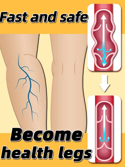 Therapy Leg Repair Pen Relieves Leg Bulge Discomfort Improving Blood Circulation Varicose Veins Pen Skin Care Product Ne